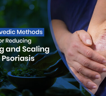 Ayurvedic Methods for Reducing Itching and Scaling in Psoriasis