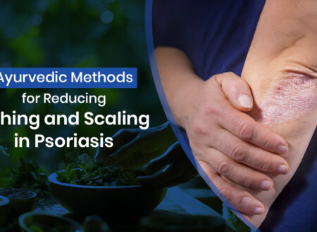 Ayurvedic Methods for Reducing Itching and Scaling in Psoriasis