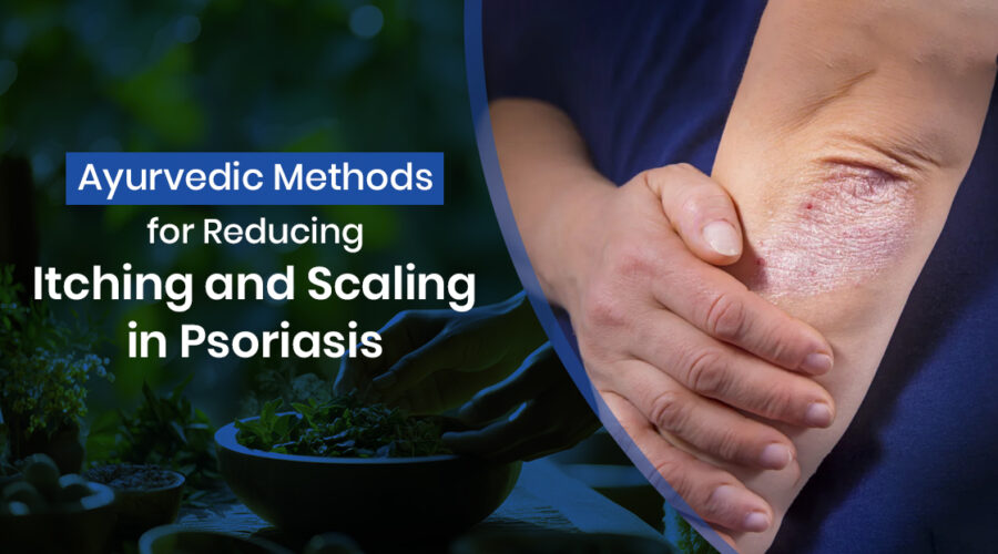 Ayurvedic Methods for Reducing Itching and Scaling in Psoriasis