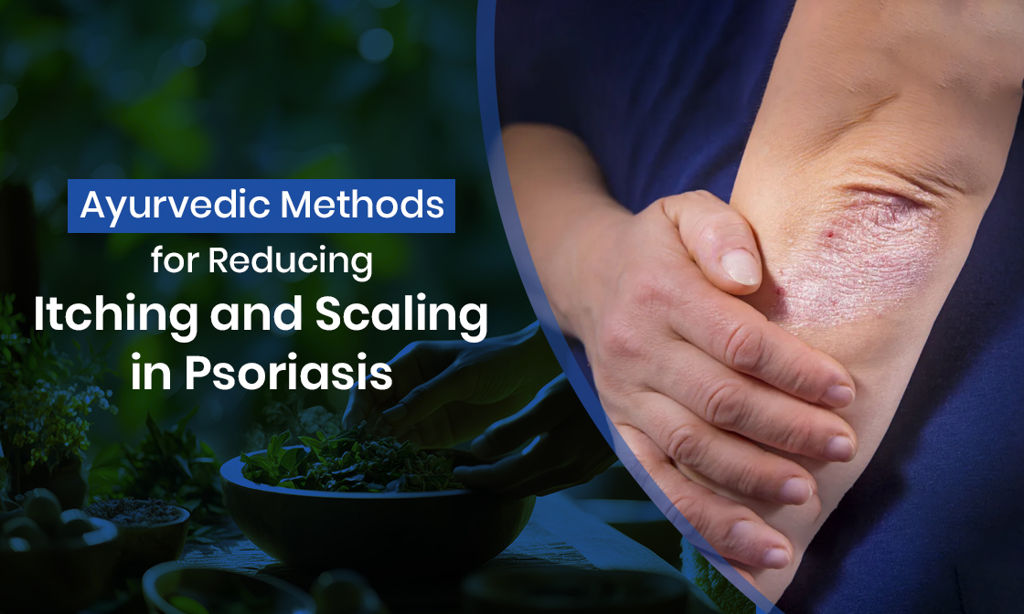 Ayurvedic Methods for Reducing Itching and Scaling in Psoriasis